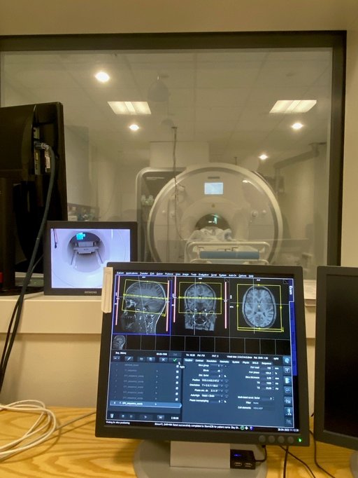 Computer showing analysis of the CT scan 